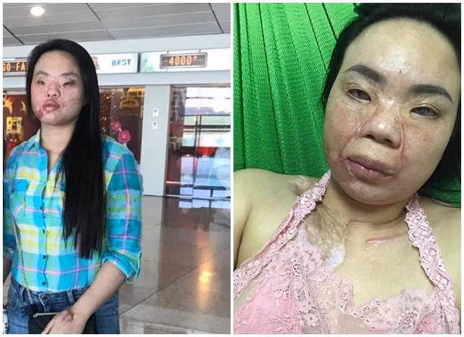 co gai xinh dep bi tat axit bien dang, ban trai 5 nam nhin thay chi noi dung 1 cau - 6