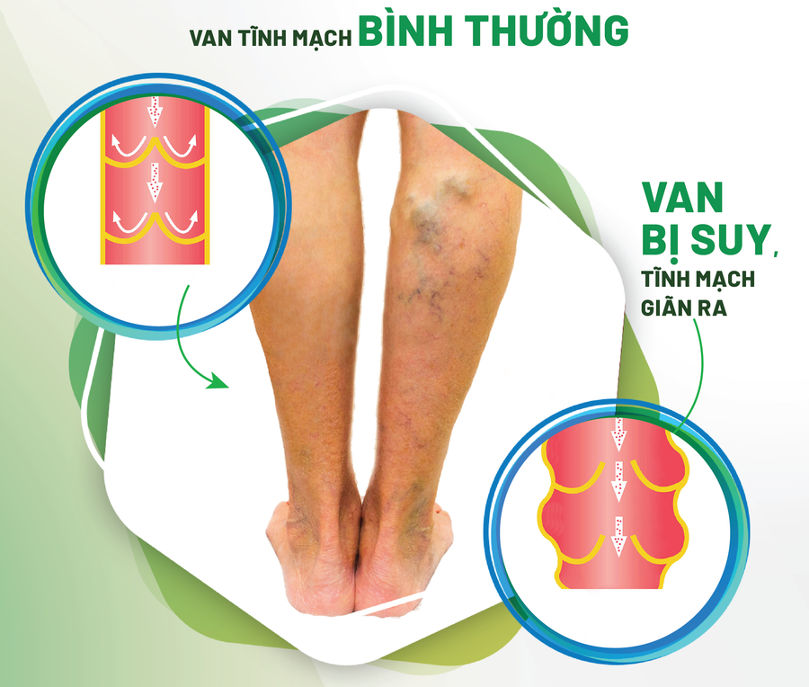 Minh họa/INT Minh họa/INT