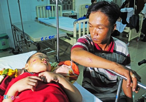 hiện trường vụ xe khách lao xuống vực, 30 hành khách bị thương hình 7 hien truong vu xe khach lao xuong vuc, 30 hanh khach bi thuong hinh 7
