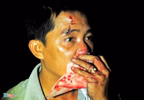 hiện trường vụ xe khách lao xuống vực, 30 hành khách bị thương hình 6 hien truong vu xe khach lao xuong vuc, 30 hanh khach bi thuong hinh 6