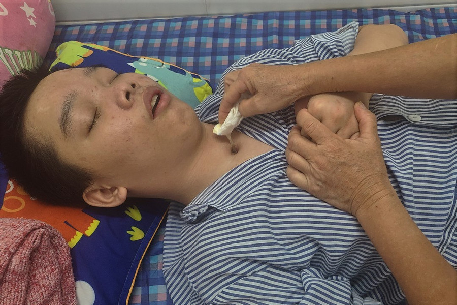 Người mẹ nghèo cầu xin sự sống cho nam sinh bị tai nạn chấn thương sọ não ảnh 3 Người mẹ nghèo cầu xin sự sống cho nam sinh bị tai nạn chấn thương sọ não ảnh 3