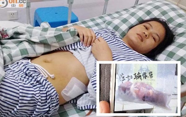 Bệnh viện bị tố ăn cắp thận bệnh nhân ảnh 1 patient-3204-1409368125.jpg