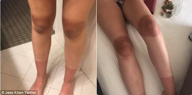 Dở khóc dở cười khi mặc quần... jean rách