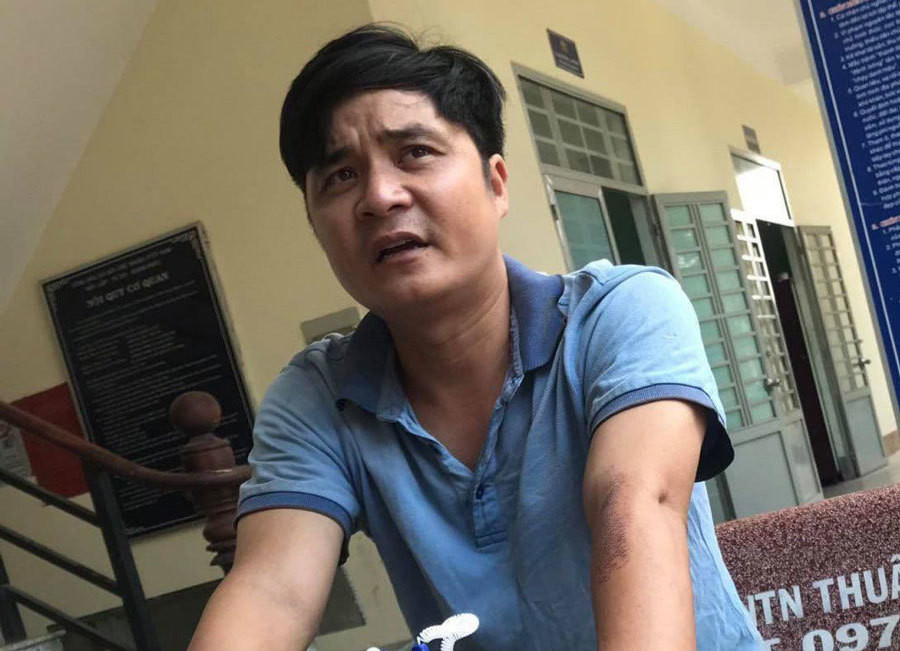 Nghi can đánh chết người sau va chạm xe máy ở Bình Dương ra đầu thú