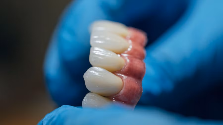 Người đàn ông 72 tuổi gặp khó khăn trong việc nuốt thức ăn (Ảnh minh họa)