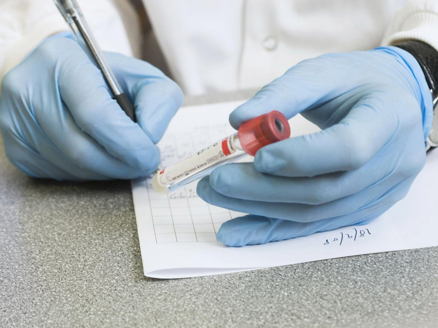 Ngỡ ngàng với phương pháp chẩn đoán ung thư bằng nước bọt chỉ trong 10 phút - Ảnh 1