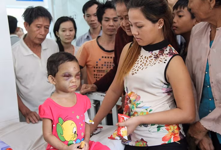 Bé Kim Ngân đang được điều trị tại bệnh viện