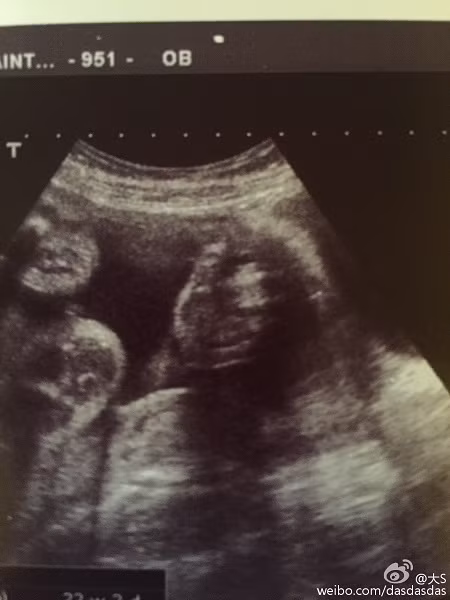 Từ Hy Viên háo hức chờ ngày sinh con trai