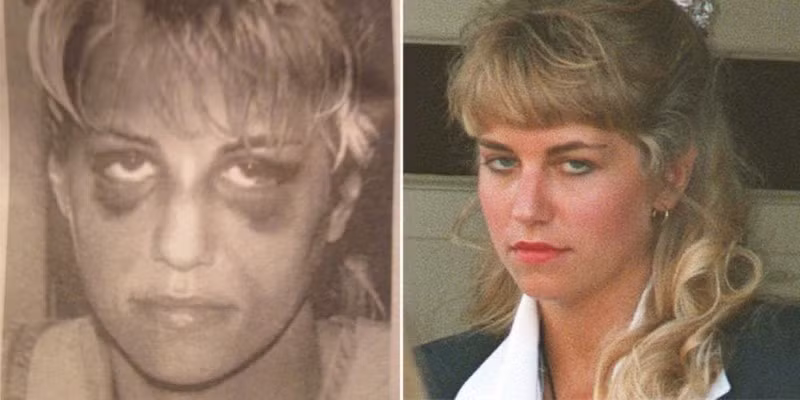 Hình ảnh Homolka (trái) bị chồng bạo lực gia đình.