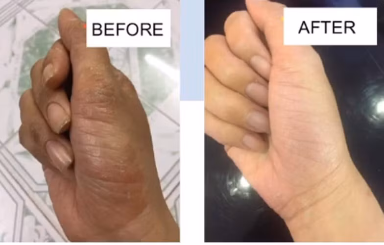 Thảo dược từ lá tre ảnh 1