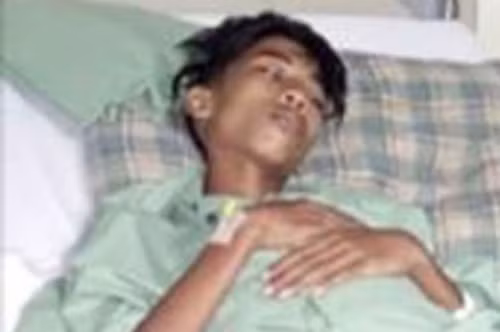 Bào thai sống ký sinh trong bụng suốt 15 năm ảnh 1