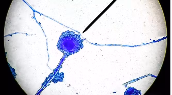 Nấm Mucormycetes gây ra bệnh "Nấm đen". Ảnh: Shutterstock.