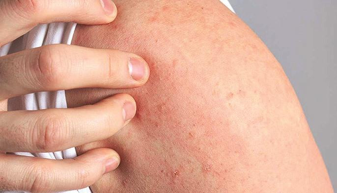 Ảnh: BV. Ảnh: BV.