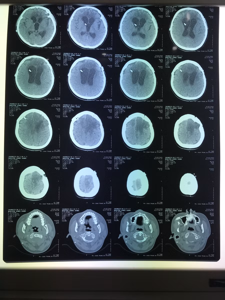 Phim chụp tình trạng bệnh nhân bước đầu ổn định