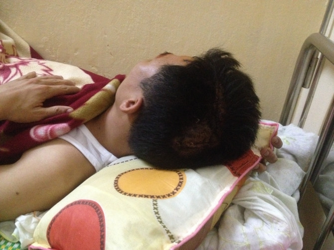 Giây phút kinh hoàng nam thanh niên bị 20 đối tượng đánh trọng thương - Ảnh 2