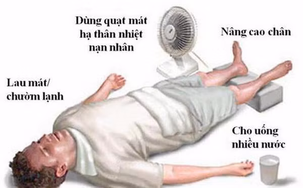 Cách cấp cứu người bị say nắng. Ảnh: SKĐS.