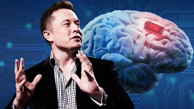 Neuralink là một công ty công nghệ thần kinh của Mỹ được thành lập bởi tỷ phú Elon Musk.