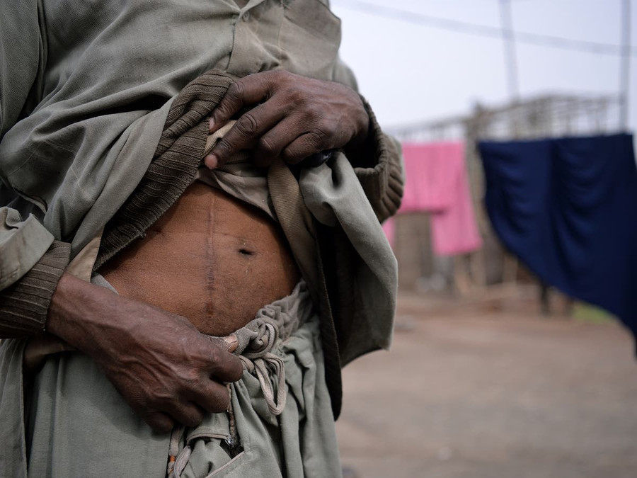 Người tị nạn có nguy cơ cao trở thành nạn nhân của việc buôn bán nội tạng.