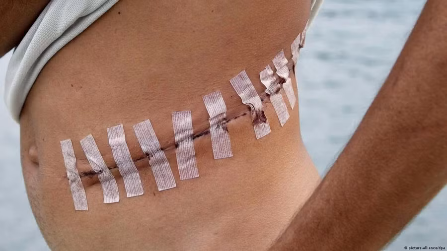 Châu Phi là khu vực tập trung nhiều "chợ đỏ" của thế giới.