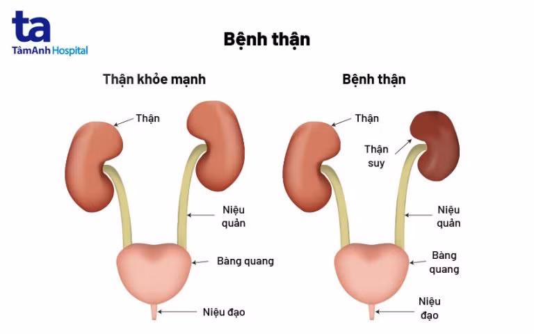 (Ảnh minh họa: ITN)
