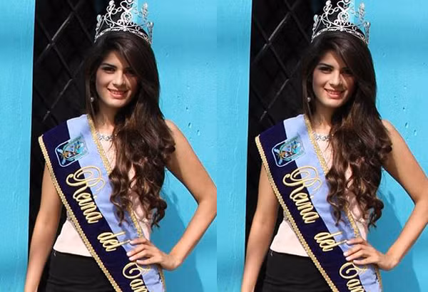 Nhan sắc hoa hậu 19 tuổi đột tử trên bàn phẫu thuật thẩm mỹ