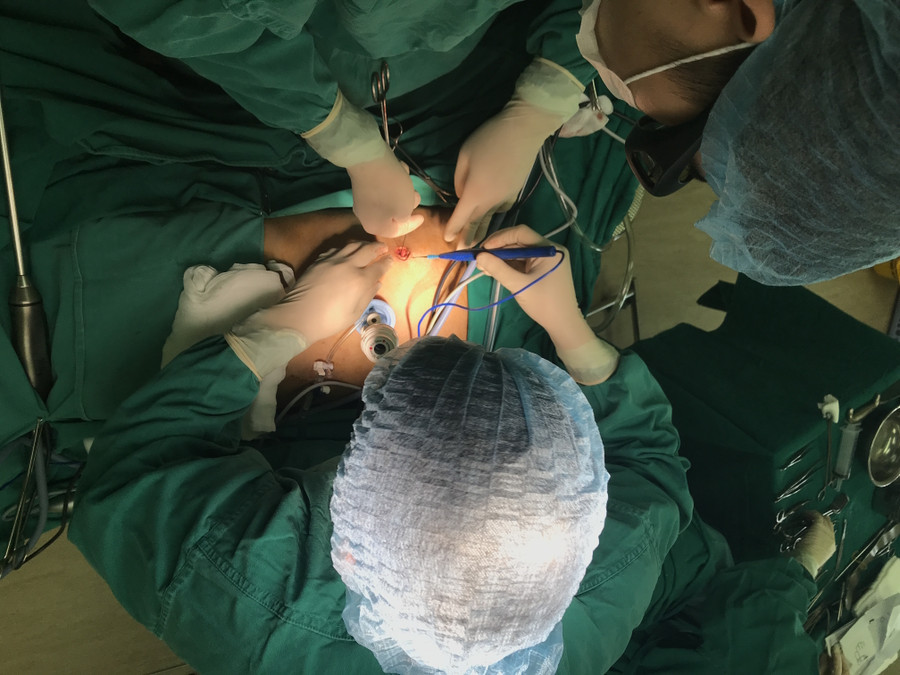 Sau mổ, chỉ để lại một sẹo nhỏ trên bụng bệnh nhân.