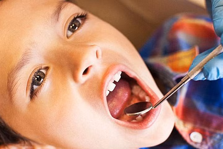 Những điều nên và không nên làm sau khi nhổ răng
