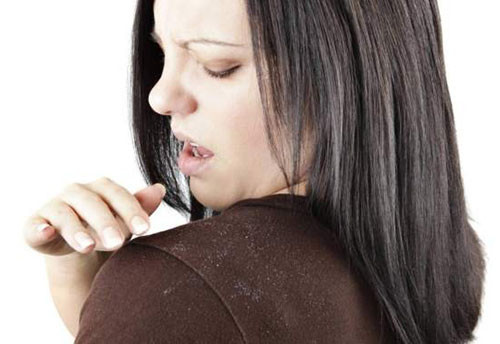 8 điều tồi tệ xảy ra khi bạn để đầu bẩn ảnh 1 8 dieu toi te xay ra khi ban de dau ban - 1