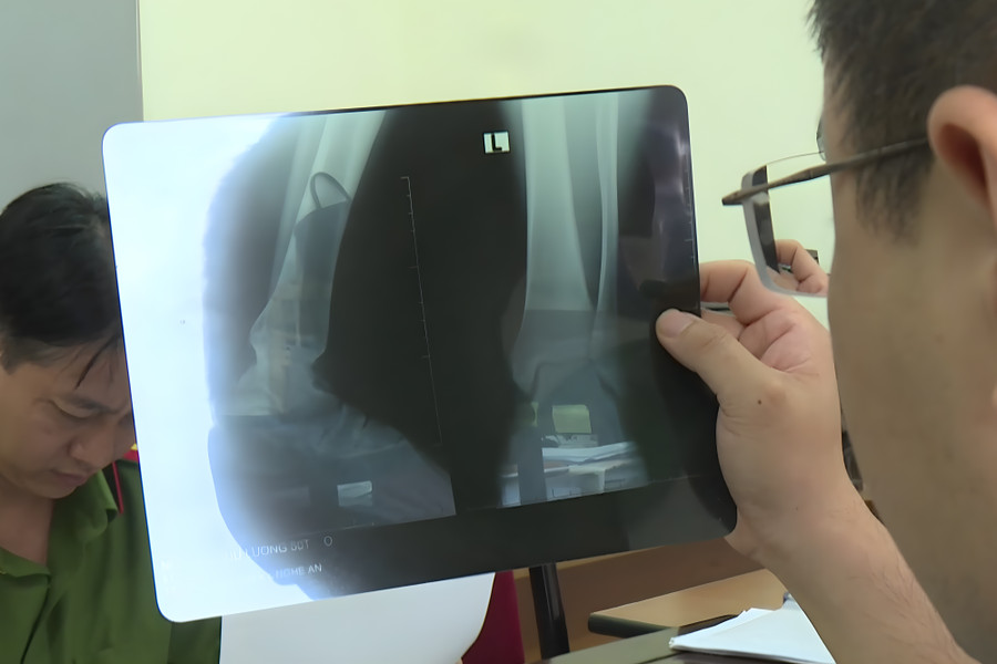 Công an kiểm tra một phim X-quang giả. Ảnh: CANA Công an kiểm tra một phim X-quang giả. Ảnh: CANA