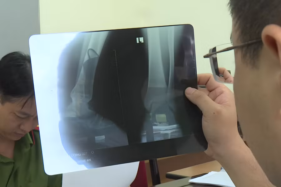 Công an kiểm tra một phim X-quang giả. Ảnh: CANA