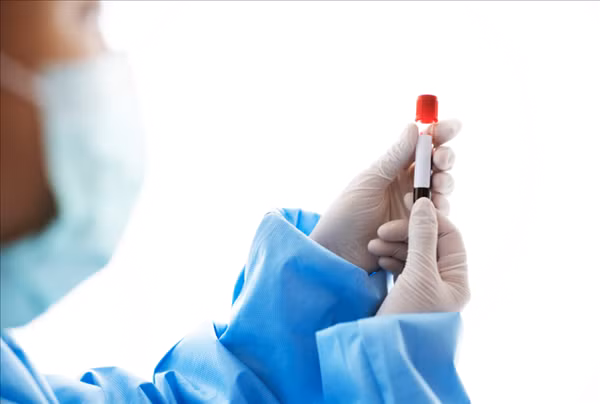 Việc xét nghiệm kháng thể sau tiêm vắc-xin ngừa Covid-19 là không cần thiết. Ảnh minh họa