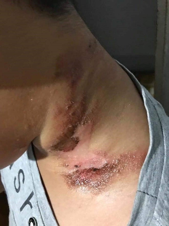 Người dân Kon Tum lùng sục loài bọ lạ bán cho thương lái xuất sang Trung Quốc ảnh 1 Người dân lùng sục loài bọ lạ bán cho thương lái xuất sang Trung Quốc - ảnh 1