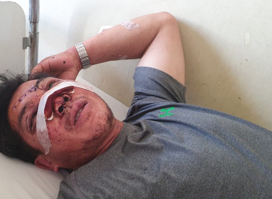 Giây phút cụ ông 91 tuổi tử vong trong vụ hai xe khách đâm nhau ở Khánh Hòa ảnh 1 Giây phút cụ ông 91 tuổi văng khỏi xe thiệt mạng ở Khánh Hòa