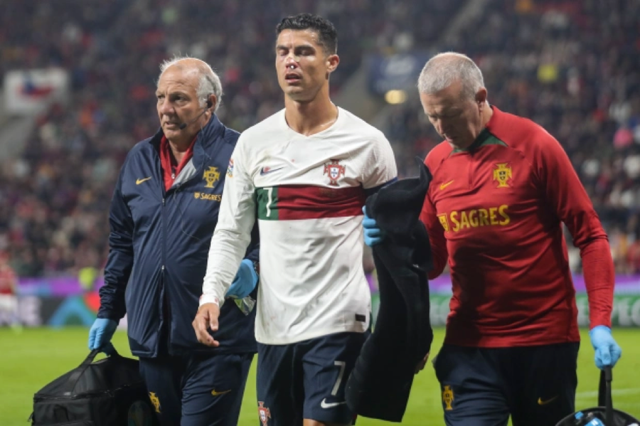 Đội ngũ y tế phải dùng miếng gạc cầm máu ở mũi cho Ronaldo. Đội ngũ y tế phải dùng miếng gạc cầm máu ở mũi cho Ronaldo.