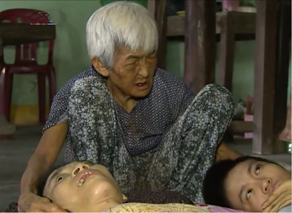 Hai người con tật nguyền vì di chứng chất độc màu da cam của cụ Gương1 Hai người con tật nguyền vì di chứng chất độc màu da cam của cụ Gương