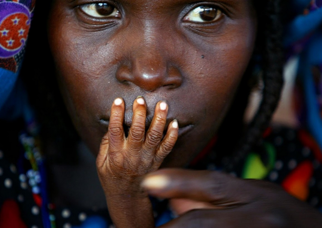 Hình ảnh bé Glassa Galisou, 1 tuổi, mắc chứng suy dinh dưỡng đang đặt bàn tay gầy gò lên miệng của mẹ em tại khu vực cung cấp thức ăn khẩn cấp ở thị trấn Tahoua, phía tây bắc Niger. Hình ảnh bé Glassa Galisou, 1 tuổi, mắc chứng suy dinh dưỡng đang đặt bàn tay gầy gò lên miệng của mẹ em tại khu vực cung cấp thức ăn khẩn cấp ở thị trấn Tahoua, phía tây bắc Niger.