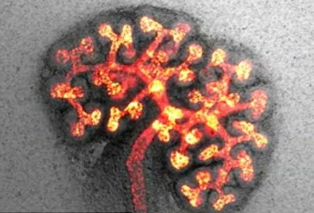 Hé lộ tiến trình hình thành quả thận bên trong cơ thể ảnh 1 Hé lộ tiến trình hình thành quả thận bên trong cơ thể ảnh 1