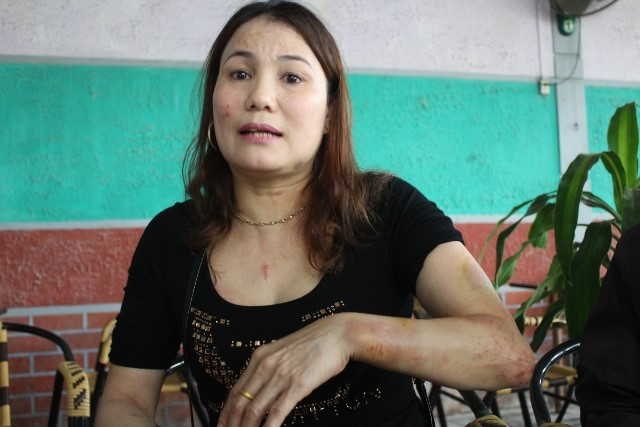 Vì sào treo quần áo, quản lý chợ ẩu đả với tiểu thương ảnh 1 Vì sào treo quần áo, quản lý chợ ẩu đả với tiểu thương ảnh 1
