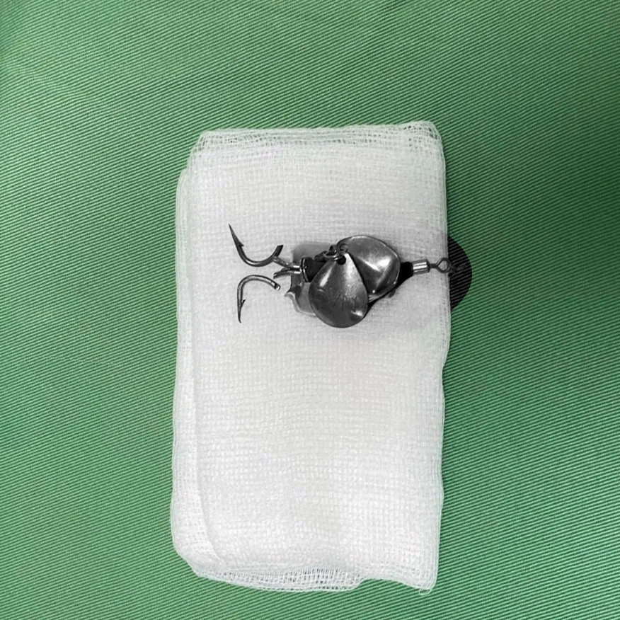 Lưỡi câu sau khi được lấy ra ngoài. Ảnh: BV. Lưỡi câu sau khi được lấy ra ngoài. Ảnh: BV.