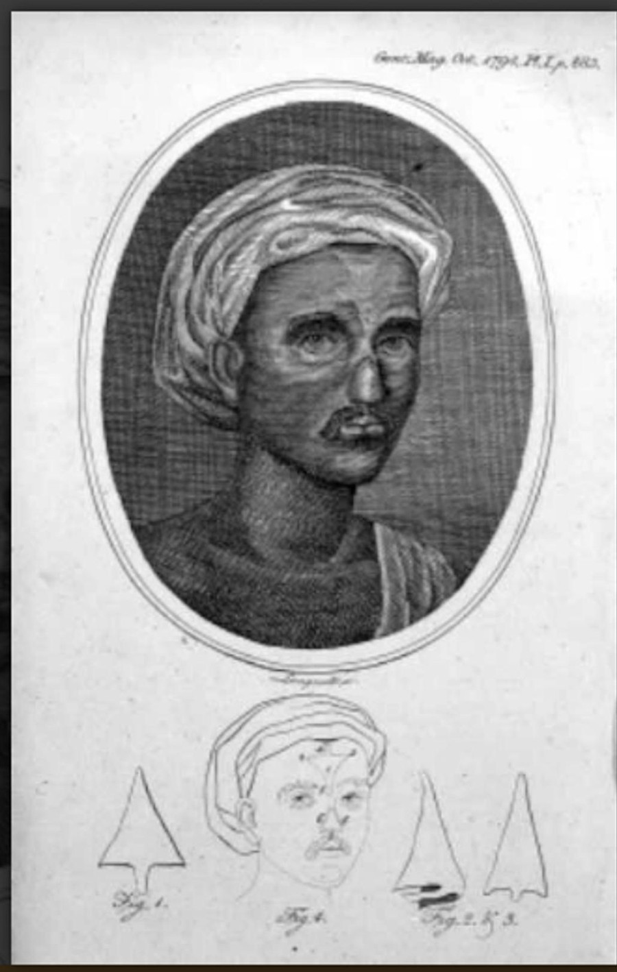Kỹ thuật sửa mũi năm 1794, áp dụng phương pháp của Sushruta hơn 2.000 năm trước. Kỹ thuật sửa mũi năm 1794, áp dụng phương pháp của Sushruta hơn 2.000 năm trước.