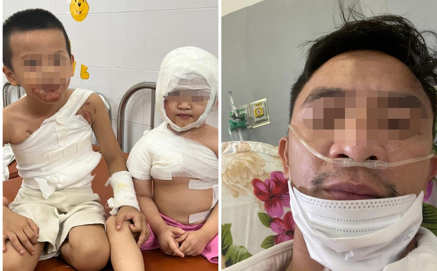 Thời gian qua, hoàn cảnh gia đình anh H. rơi vào túng quẫn khi bản thân anh bị biến chứng Covid-19 thường xuyên phải nhập viện, 2 con nhỏ bị bỏng nặng. (Ảnh: NVCC). Thời gian qua, hoàn cảnh gia đình anh H. rơi vào túng quẫn khi bản thân anh bị biến chứng Covid-19 thường xuyên phải nhập viện, 2 con nhỏ bị bỏng nặng. (Ảnh: NVCC).