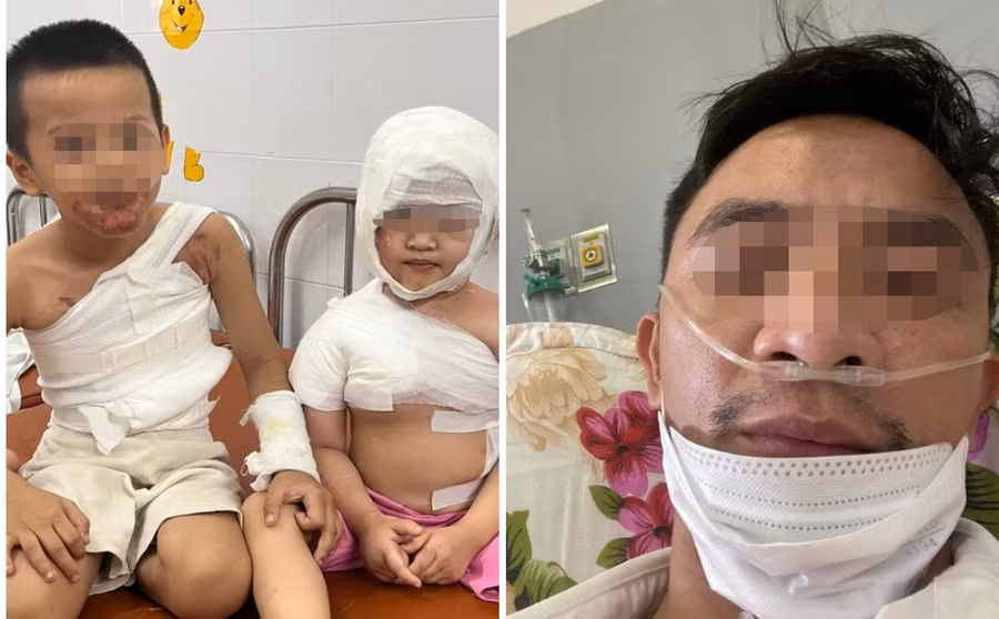 Thời gian qua, hoàn cảnh gia đình anh H. rơi vào túng quẫn khi bản thân anh bị biến chứng Covid-19 thường xuyên phải nhập viện, 2 con nhỏ bị bỏng nặng. (Ảnh: NVCC).