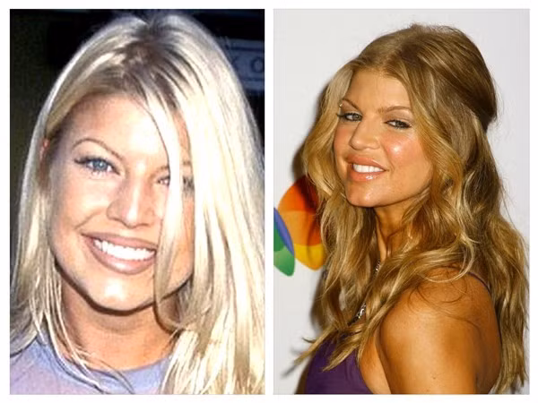 Fergie