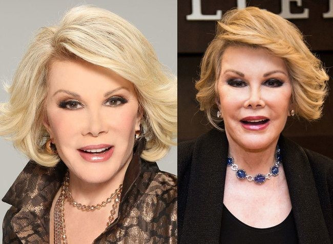 Joan Rivers đã chỉnh sửa hầu như toàn bộ gương mặt để thành thảm họa. Joan Rivers