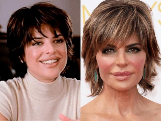 Lisa Rinna có làn môi sưng phồng khiến ít người dám đối diện. Lisa Rinna