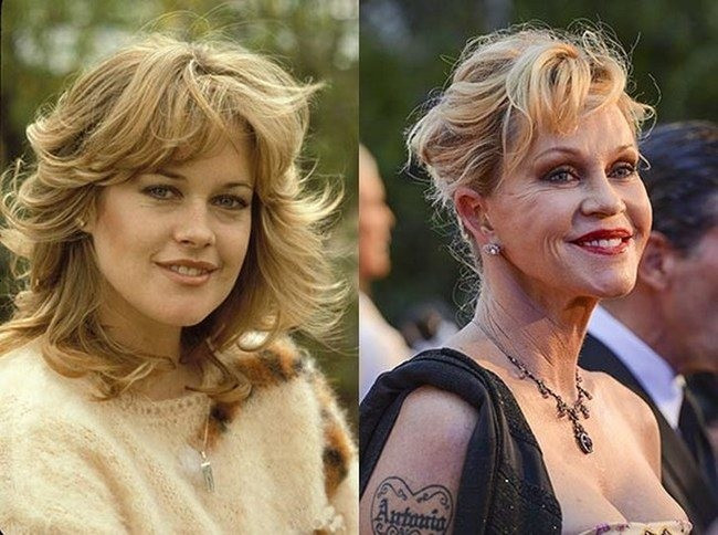 Melanie Griffith vẫn cố cứu lại nhan sắc dù gương mặt bà đã gần như phá hỏng. Melanie Griffith