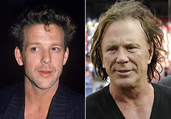 Mickey Rourke với bộ mặt nhàu nhĩ sau bao lần chỉnh sửa. Mickey Rourke