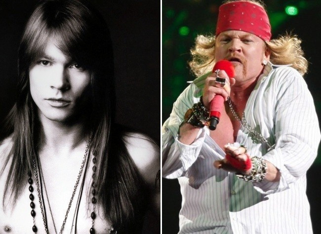 Axl Rose, thành viên của Guns N’ Roses ngày càng xuống sắc vì thời gian và cả dao kéo. Axl Rose