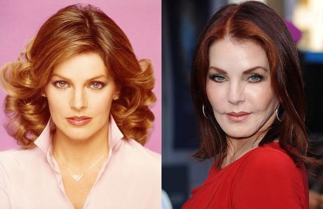 Nữ diễn viên Priscilla Presley đã biến gương mặt xinh đẹp trở nên khô cứng với các lần chỉnh sửa quá tay. Priscilla Presley
