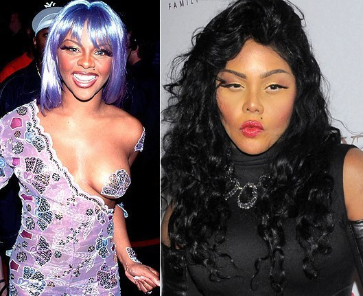 Lil Kim với toàn bộ gương mặt biến dạng. Lil Kim